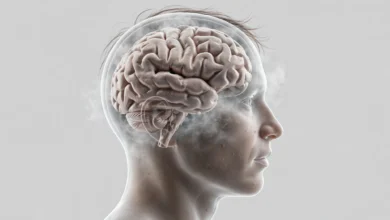 Brain fog